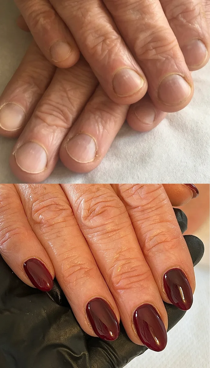 A nail treatment by Sophie, before and after